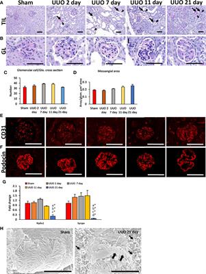 Podocyte Injury Through Interaction Between Tlr8 and Its Endogenous Ligand miR-21 in Obstructed and Its Collateral Kidney